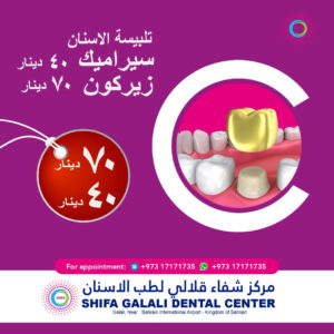 Ceramic Dental Crown 👑