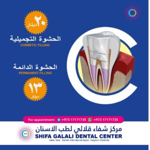 Cosmetic Dental Filling